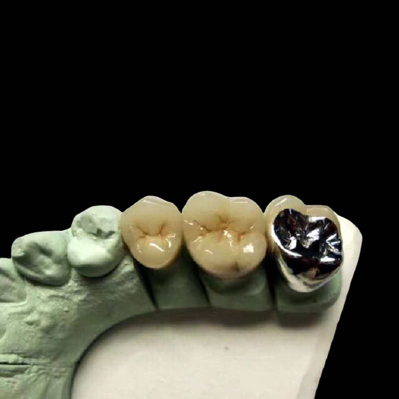 Digital Dental Lab Crowns - TopWay Dental Lab
